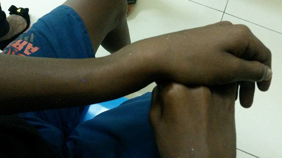 Descaso: “Quem falou que ele quebrou o braço ?”, perguntou o médico na Santa Casa de Cruzeiro nesta quarta-feira (05/10)