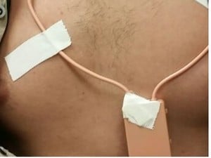 Candidato é preso por usar ponto eletrônico durante Enem no Ceará
