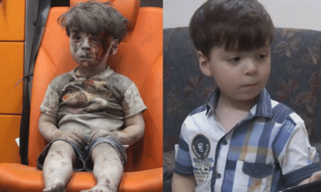 Menino sírio que comoveu o mundo aparece saudável