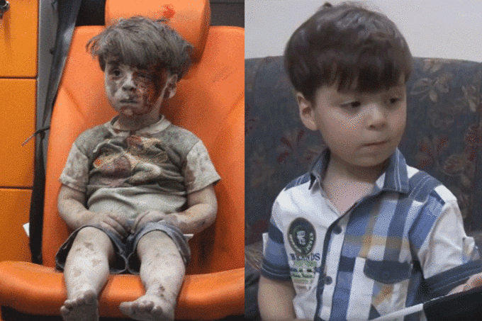 Menino sírio que comoveu o mundo aparece saudável