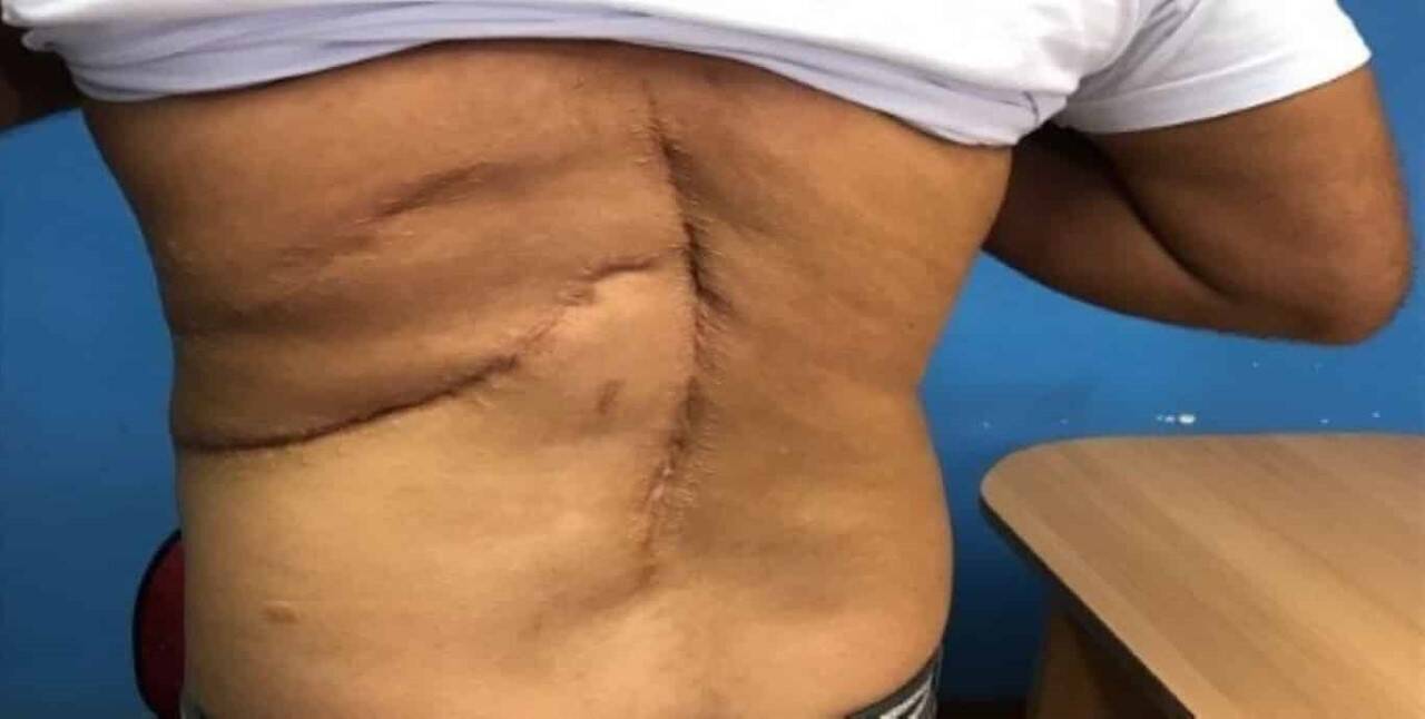 Jessica Brady regra para diagnóstico preciso de câncer deve ser ampliada em clínicas da Inglaterra em 2025