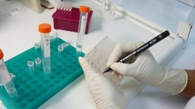 Cientistas de SP investigam medicamentos contra doenças parasitárias tropicais