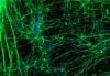 Unicamp: Estudo aponta que novo coronavírus é capaz de infectar neurônios humanos
