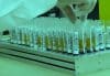 COVID-19: Técnica usa inteligência artificial para prever risco de complicações