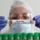 China registra primeira morte humana no mundo por gripe aviária H3N8, diz OMS