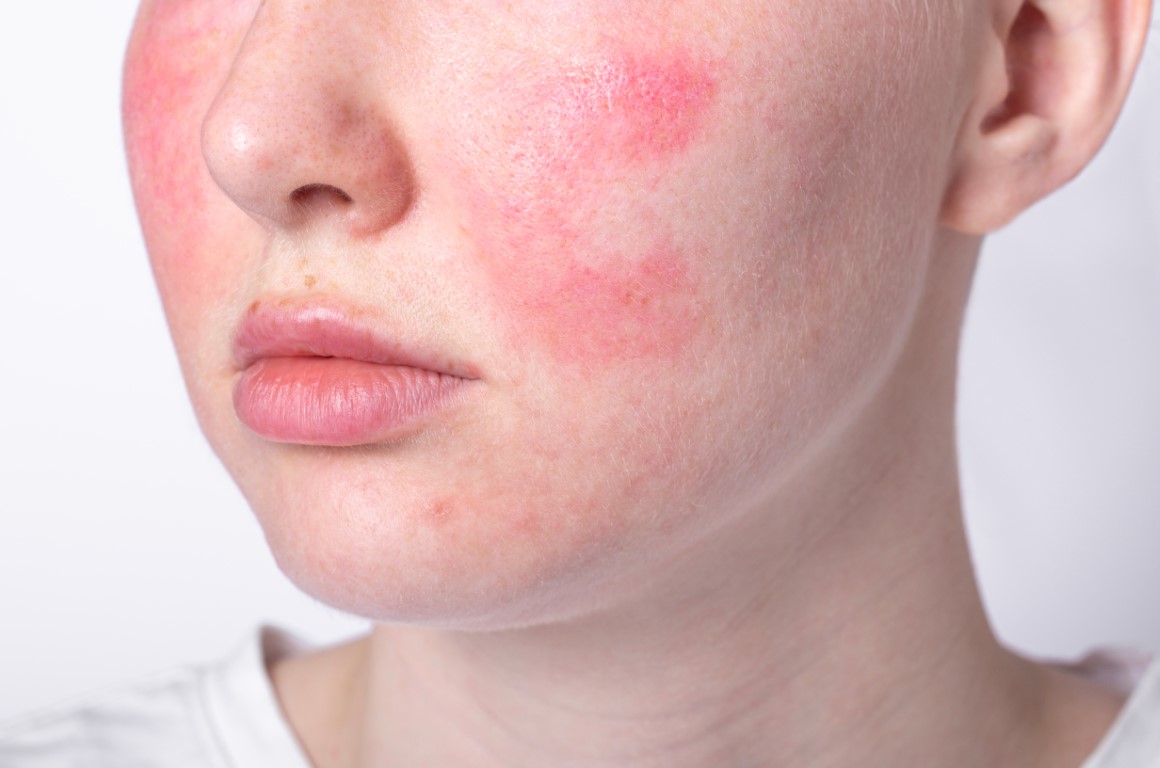 pele tratamento dicas dermatologia