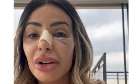 'Achei que eu tinha morrido', conta Janaína Prazeres, que denunciou namorado por agressões na França