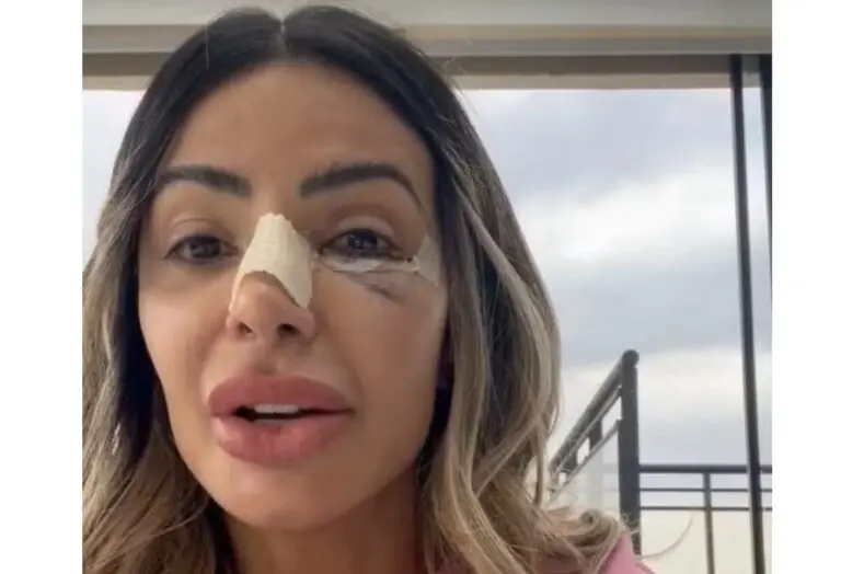 'Achei que eu tinha morrido', conta Janaína Prazeres, que denunciou namorado por agressões na França