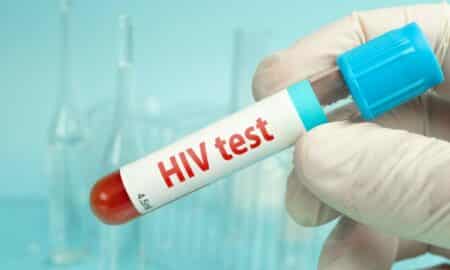 HIV