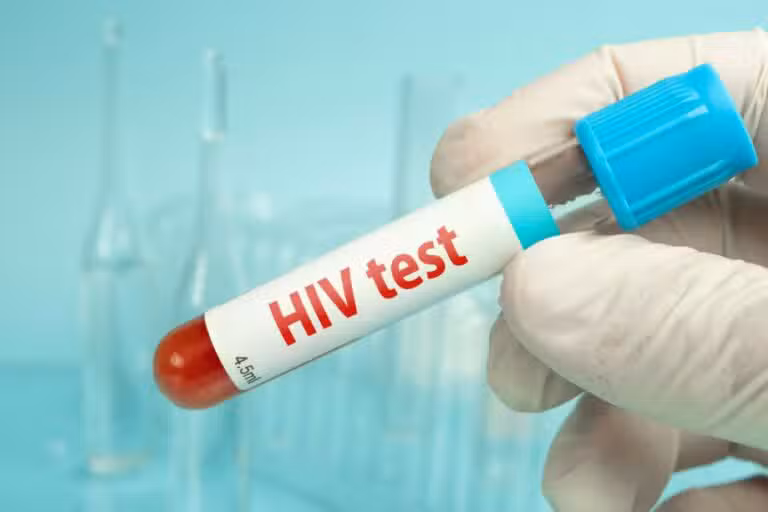 HIV