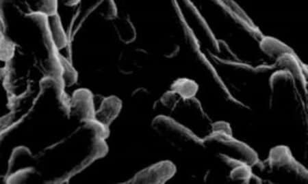 tuberculose