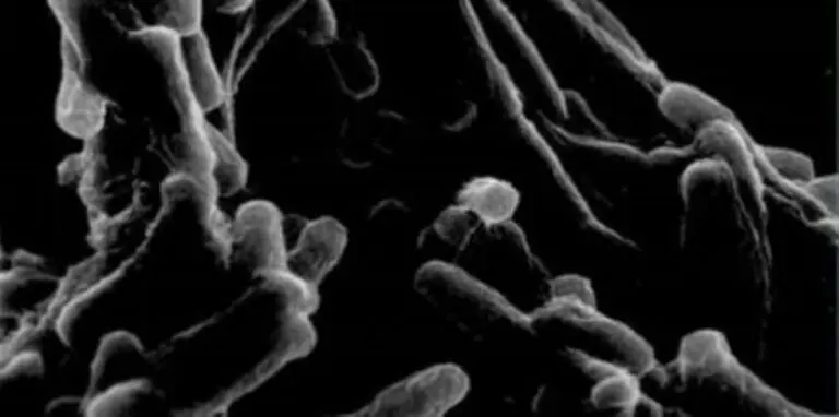 tuberculose