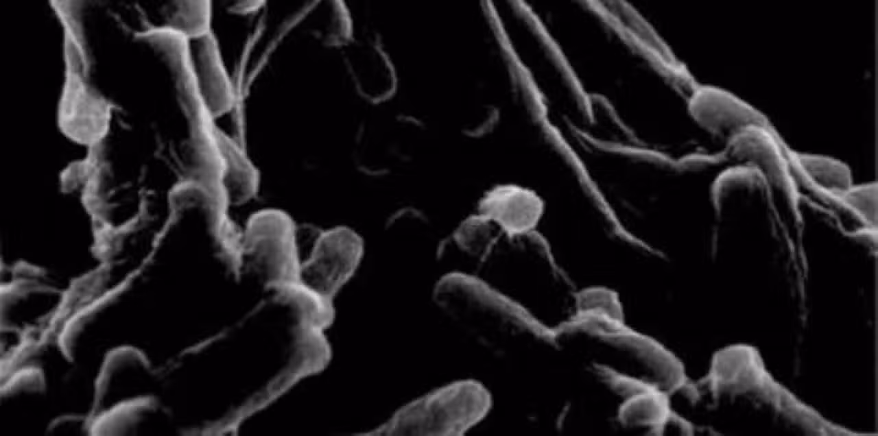 tuberculose