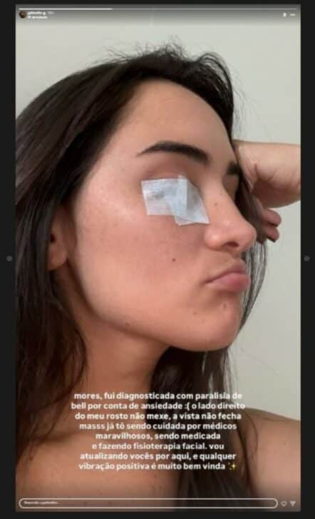 Gabi Melim compartilha que tem paralisia de Bell