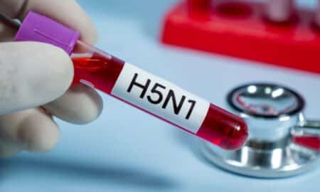H5N1 Vírus