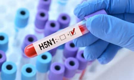 Vírus H5N1