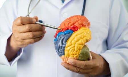 Alzheimer