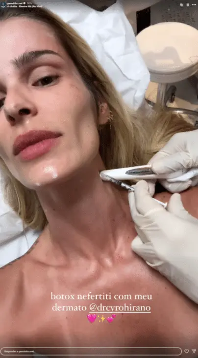Botox de Yasmin