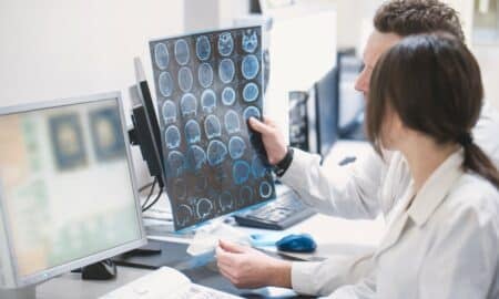 Avc -Exame - Cerebro - Acidente Vascular Cerebral