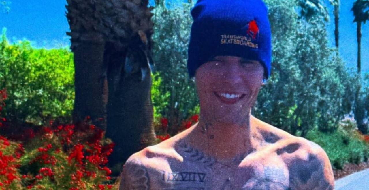 Justin Bieber at Coachella 2025: Viral Videos Reignite Concerns Over Mental Health and Well-Being