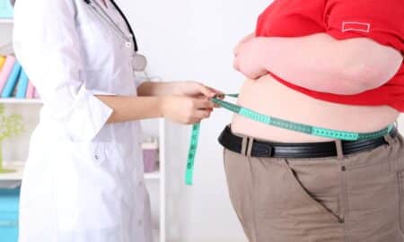Obesidade, Cirurgia Bariátrica