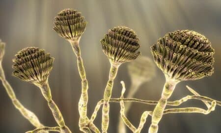 Aspergillus