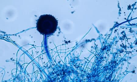 Aspergillus