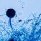 Aspergillus