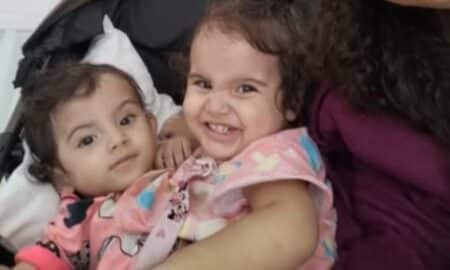 Gêmea siamesa Kiraz e Aruna