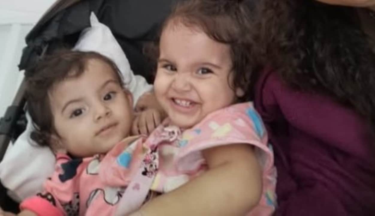 Gêmea siamesa Kiraz e Aruna
