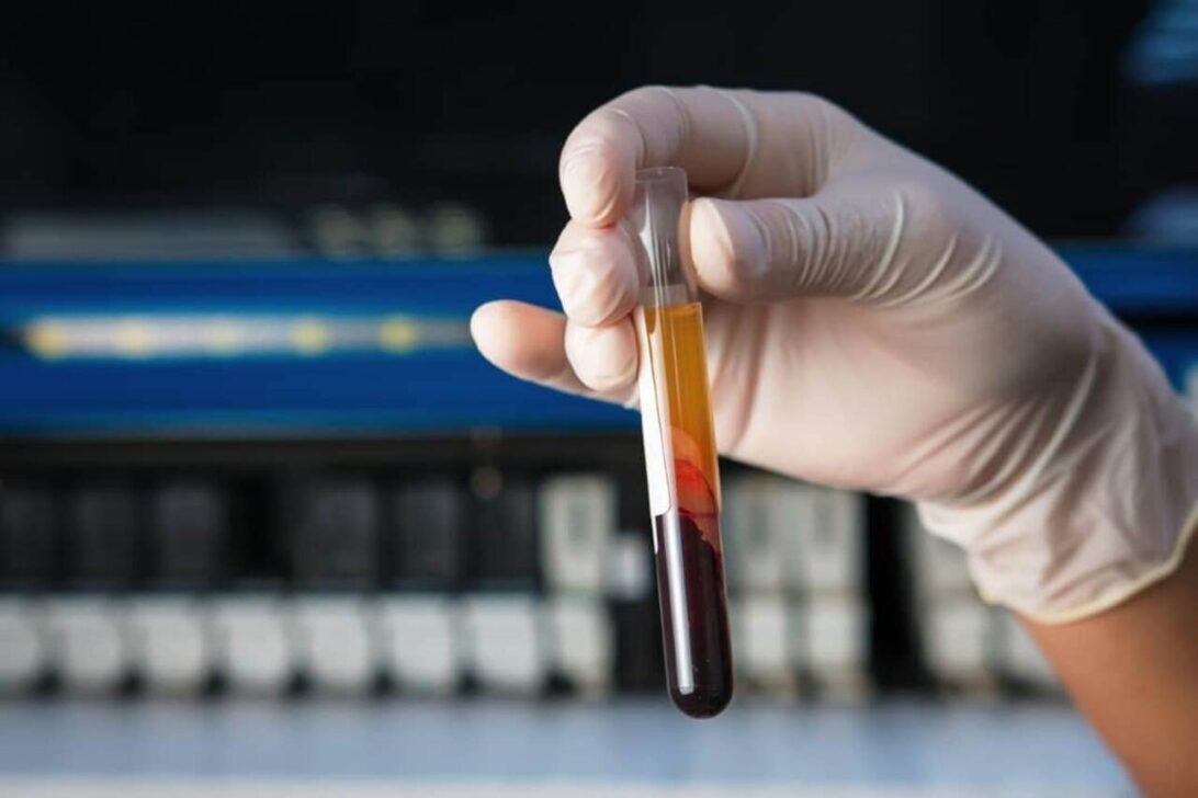 Blood cancer