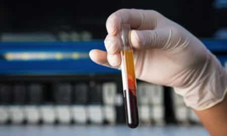 Blood cancer