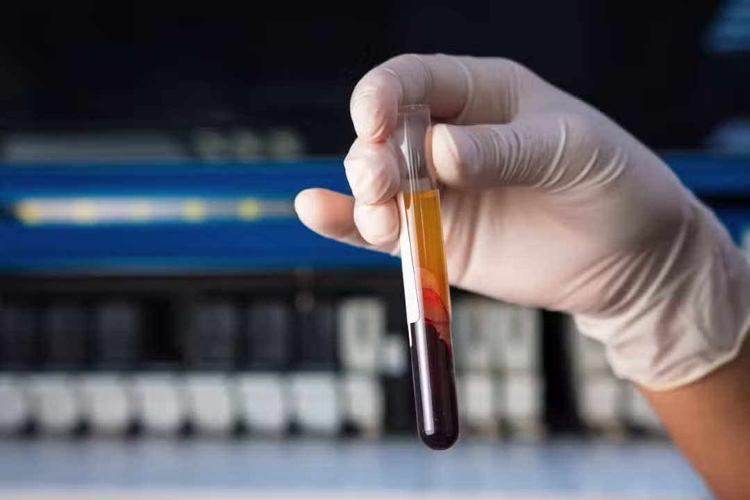 Blood cancer