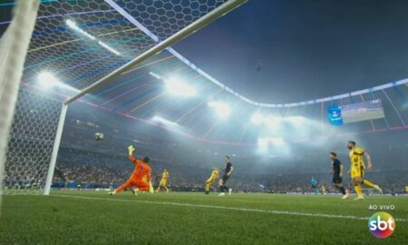 psg doue