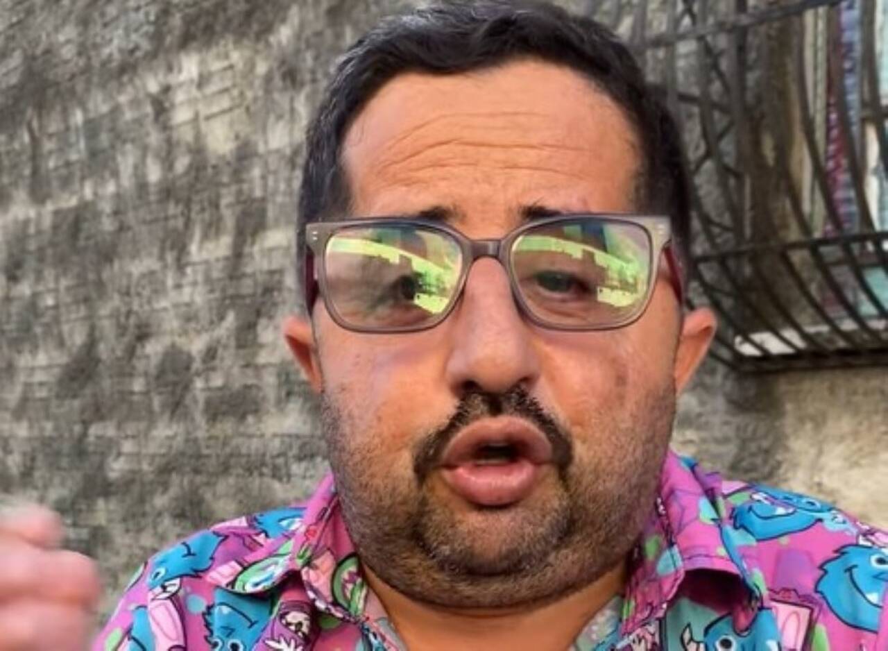 Bolachinha passa por cirurgia após cair em buraco durante gravação na Record