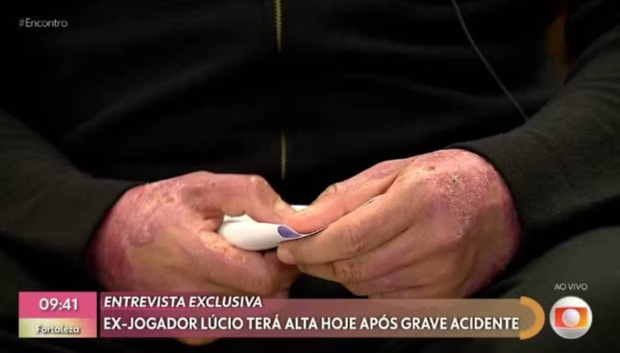 ex jogador mao lucio