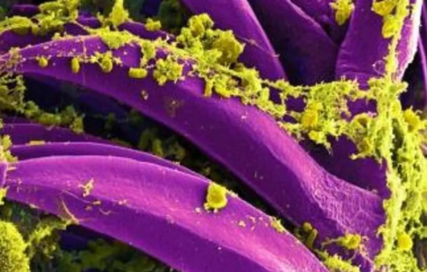 A peste pneumônica é uma infecção pulmonar causada pela bactéria Yersinia pestis, tipicamente encontrada em roedores Foto: National Institute of Allergy and Infectious Diseases
