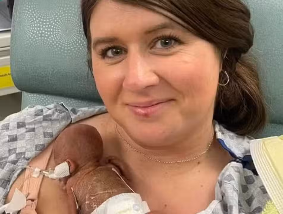 Bebê mais prematuro do mundo' com a mãe, Mollie Keen