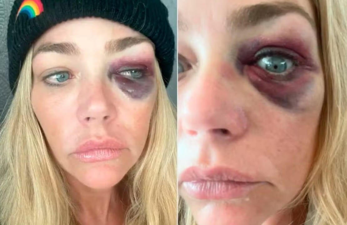 Denise Richards