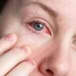 olhos azuis