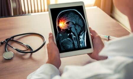 Médico com exame de raio-x do crânio