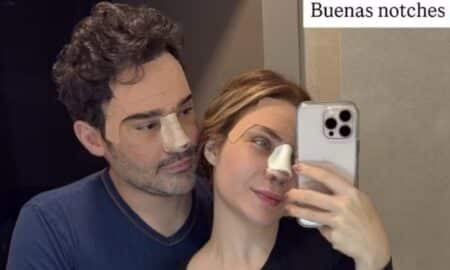 Fernando Zor e Lara Bissi Rinopplastia