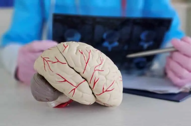 Médico modelo de cerebro exame