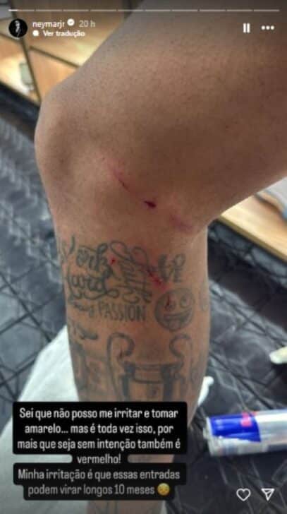 Neymar mostra joelho machucado