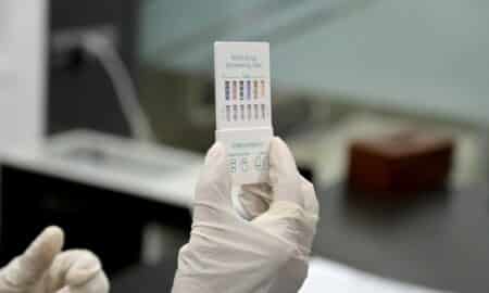 Teste exame toxicológico