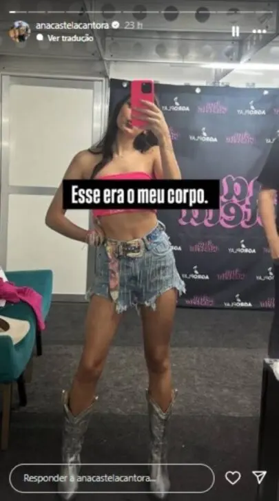 Ana Castela exibe antes x depois