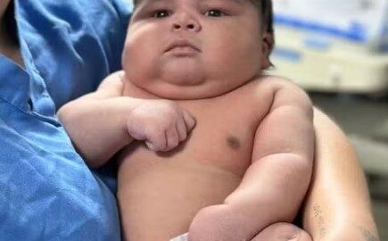Bebê nasce com 6,5 kg
