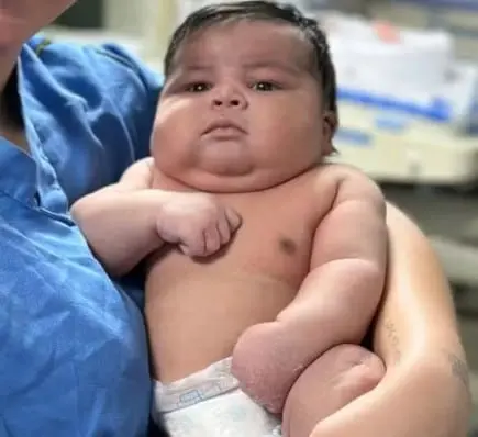 Bebê nasce com 6,5 kg