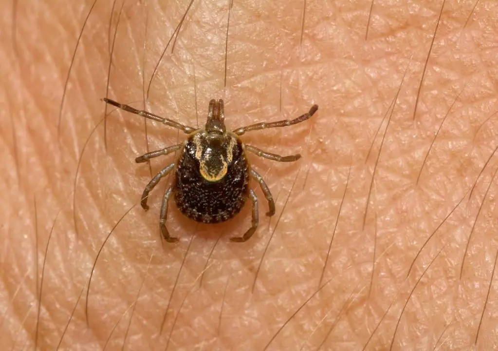 Febre maculosa