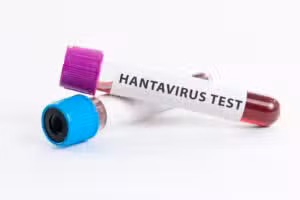 WHO phủ nhận nguy cơ bùng phát hantavirus trên tàu ở Đại Tây Dương
